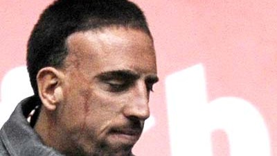Fußball-DFB-Pokal: Musste gegen Bremen noch verletzt zuschauen: Franck Ribéry.