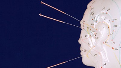 Akupunktur: Wieso soll eigentlich gerade hier gestochen werden?