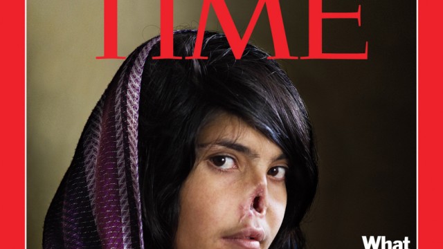 Umstrittenes Cover des "Time Magazine": Dieses Bild von Bibi Aisha erhitzt derzeit die Gemüter.