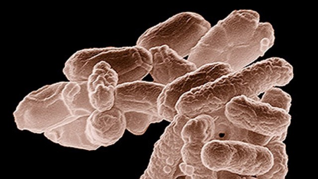 Handout of electron micrograph of E. coli bacteria
